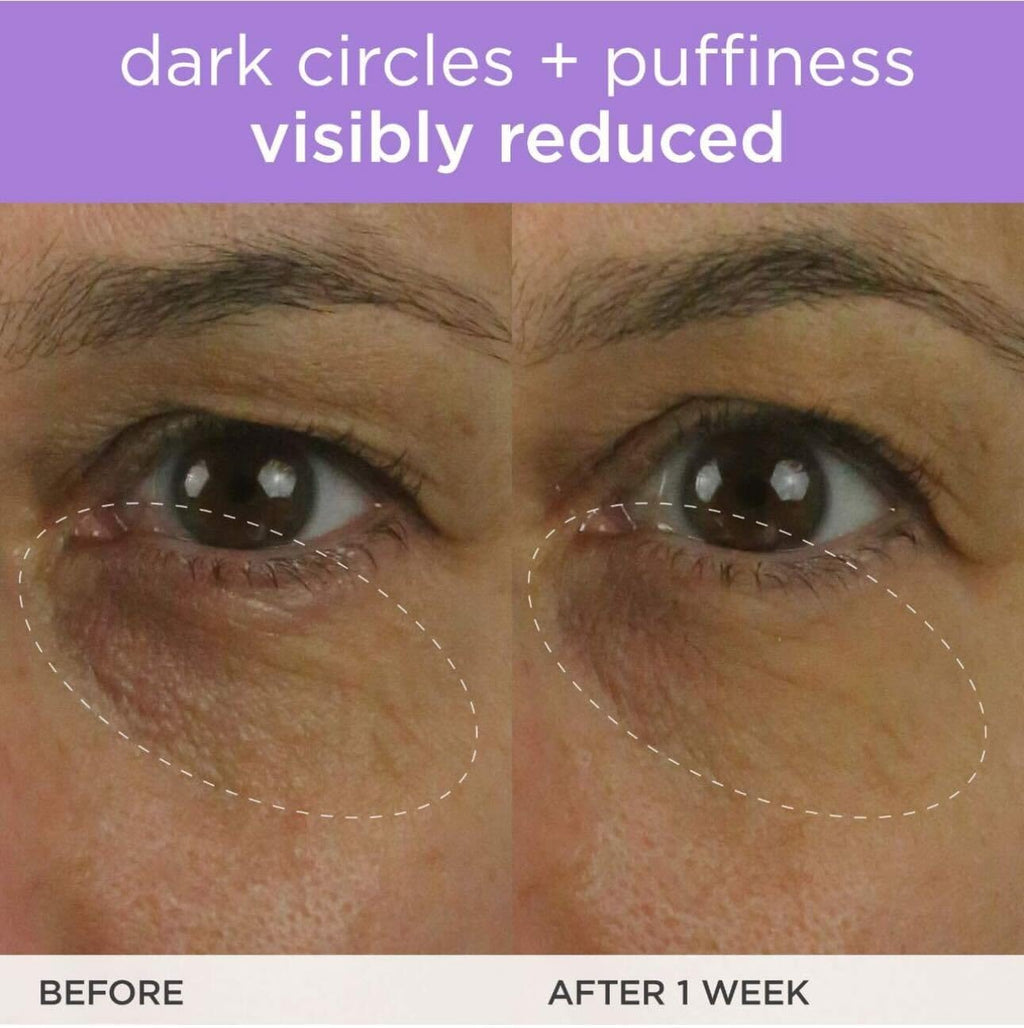TATCHA The Brightening Eye Cream, Dark Circle Reduction with Vitamin C