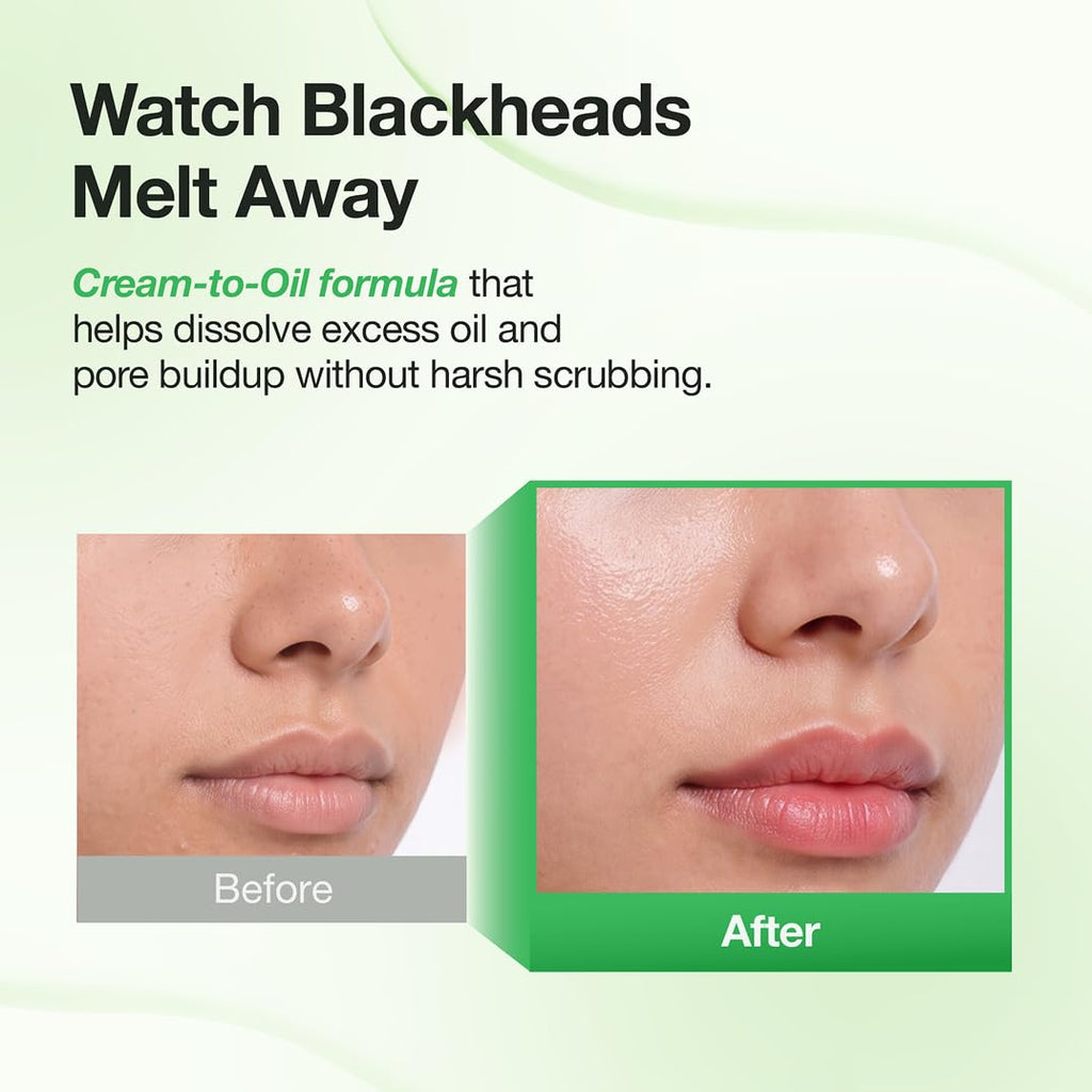 FULLY Pore Peptide Sebum Melting Cream to Oil Peeling Gel for Blackhead